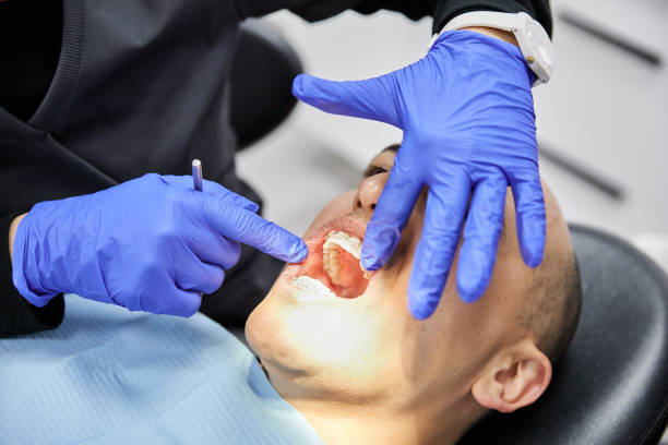 Best Emergency Gum Treatment in Bardmoor, FL