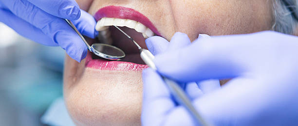 Best Emergency Dental Care for Broken or Chipped Teeth in Bardmoor, FL